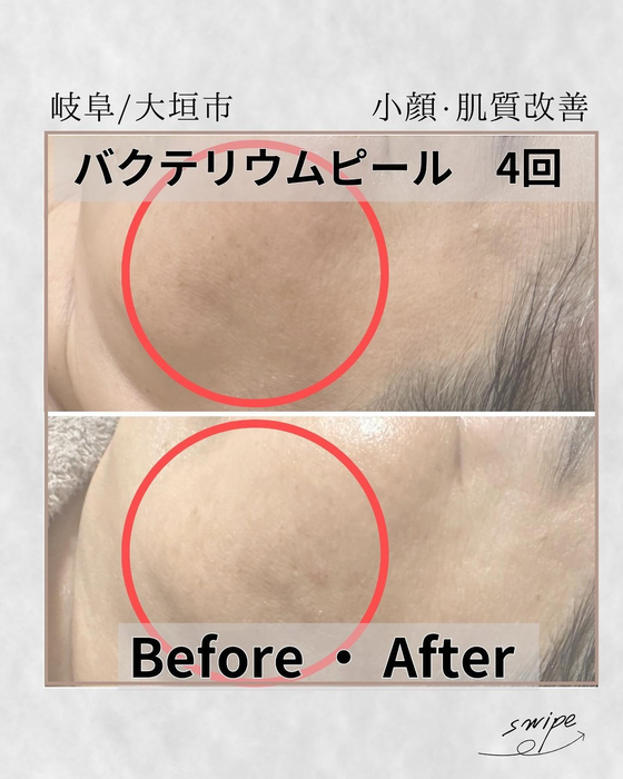 画像1011
