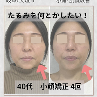 画像1023