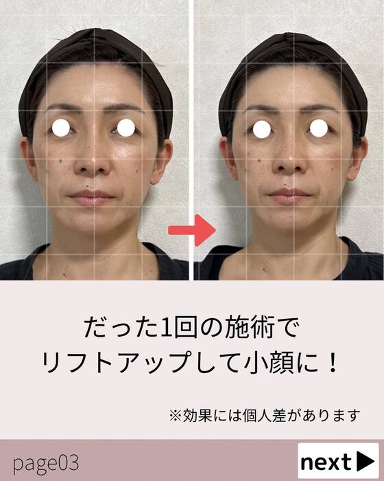 画像404