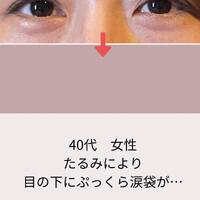 画像421