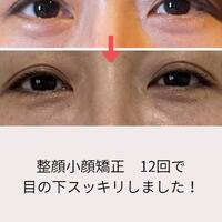 画像422