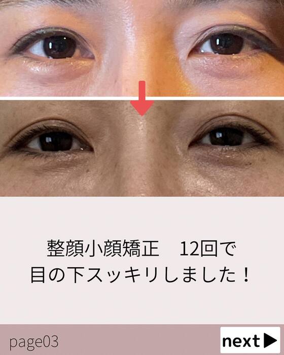 画像422