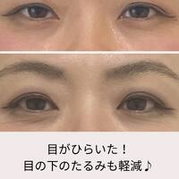 画像426