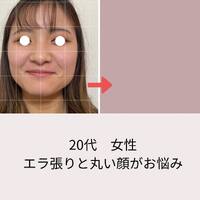 画像452