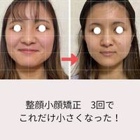 画像453