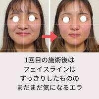 画像454