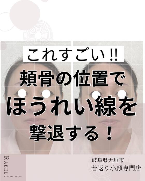 画像533