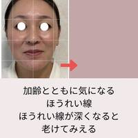 画像534