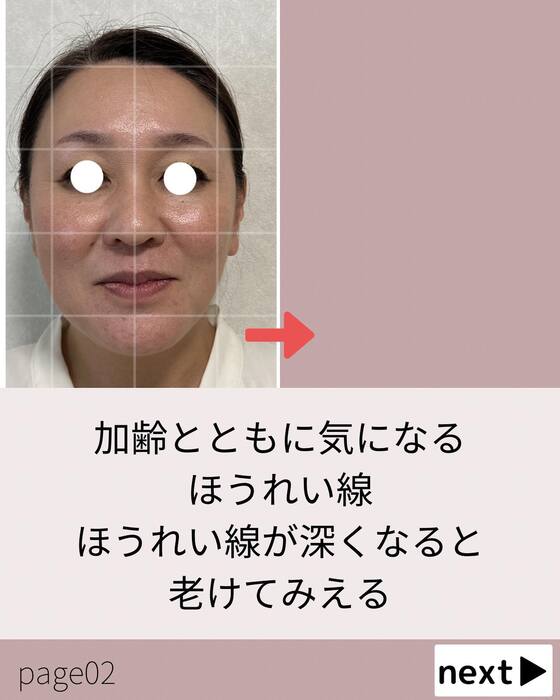 画像534