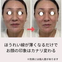 画像535