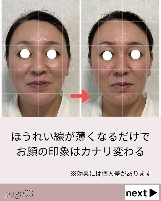 画像535