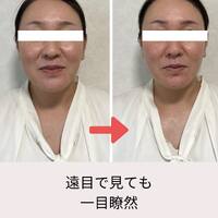 画像536
