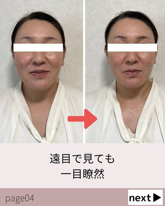 画像536