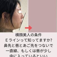 画像552