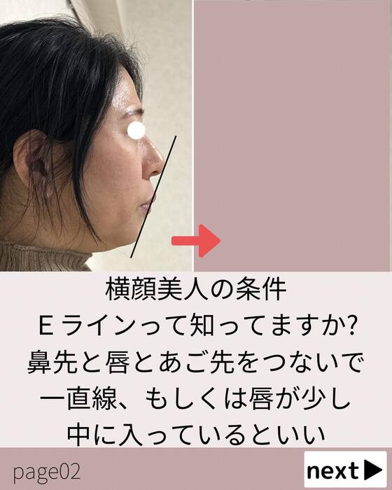 画像552
