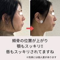 画像553