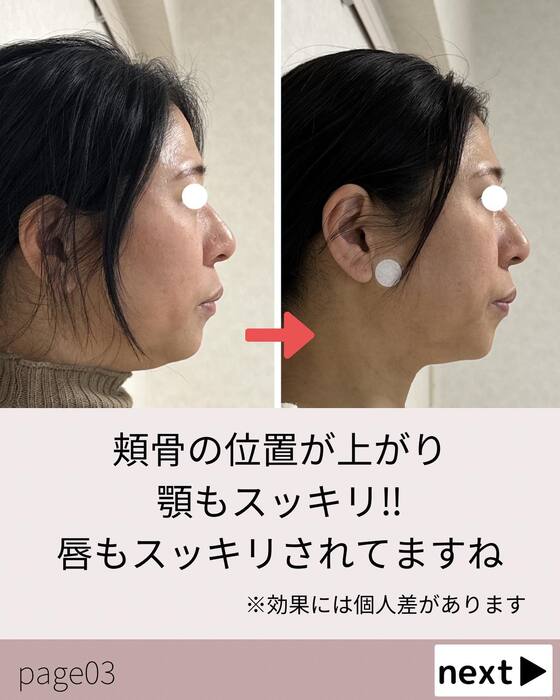 画像553