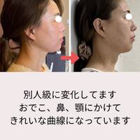 画像555