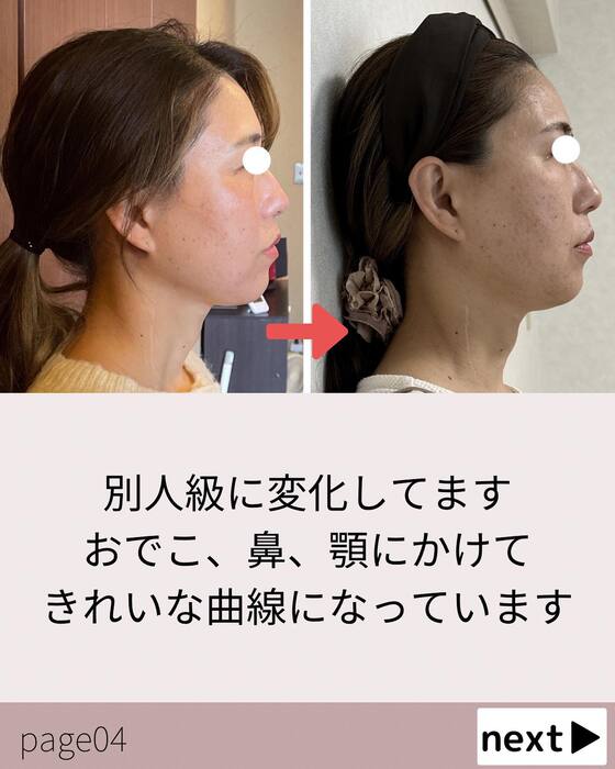 画像555
