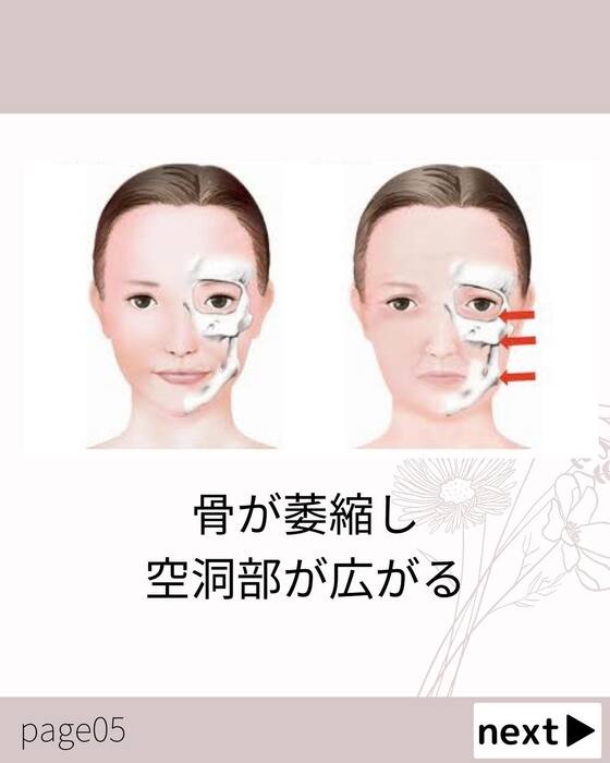 画像614