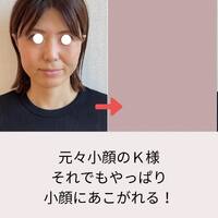画像622