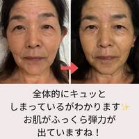 画像710