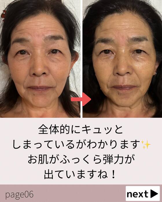 画像710