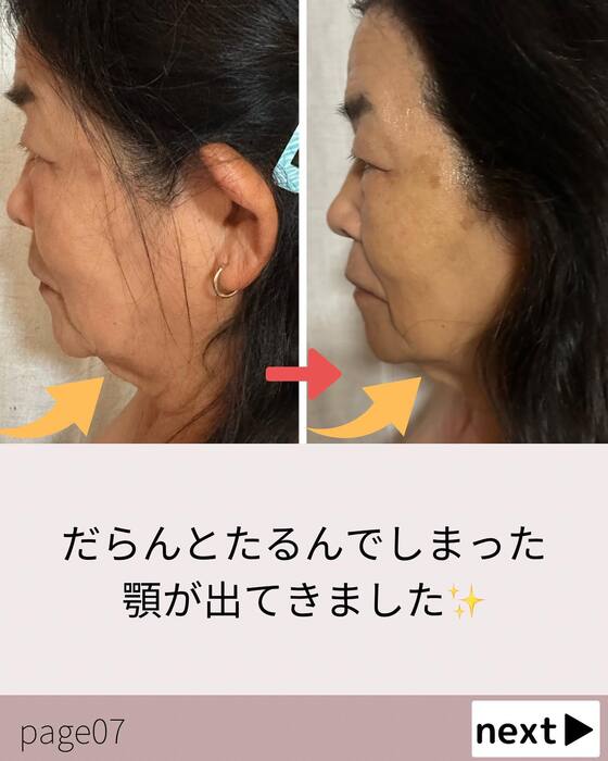 画像711