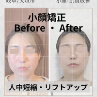 画像858
