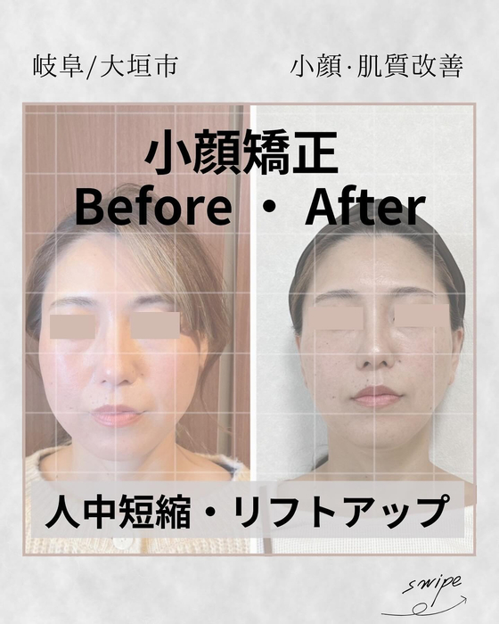 画像858