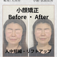 画像876