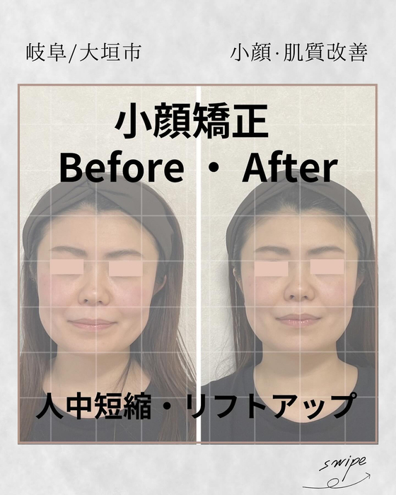 画像876