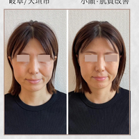 画像893